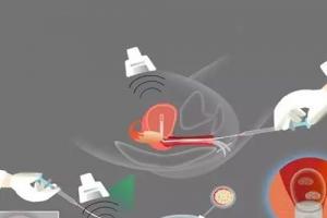 盘点导致男女不孕的四种因素，送上四大试管助孕“秘诀”