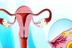 卵巢黄体囊肿会影响试管婴儿移植吗-慎重选择可扭转局面