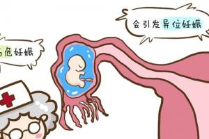 试管婴儿异位妊娠是怎么引起的-请看原因介绍
