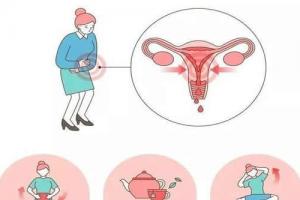 专家辟谣做试管婴儿促排并不会导致女性提前闭经