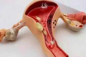 什么样的子宫内膜是好内膜？养好内膜4妙招！