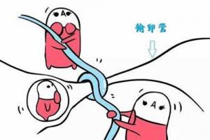分享治疗输卵管堵塞最先进的5种办法-建议收藏