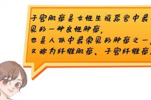 子宫肌瘤能通过试管助孕成功吗-早发现早治疗