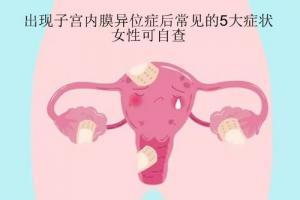 出现子宫内膜异位症后常见的5大症状-女性可自查