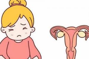 专家解读子宫内膜异位症常见5大症状-内含内异症确诊手段