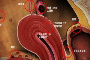 专家科普-子宫内膜异位症治疗方式(内含术后调养身体办法)