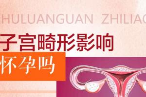 细说子宫畸形会导致不孕不育吗-女性朋友注意了