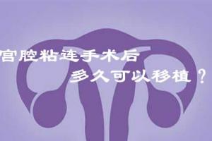 生殖专家提醒宫腔粘连术后建议3-6个月后再进行试管胚胎移植