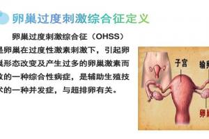 试管婴儿常见的6种并发症
