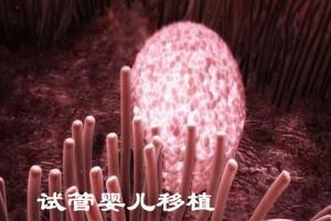 分享5个能让试管婴儿胚胎移植后更容易着床的小妙招-经证实很有效