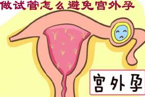 做试管婴儿怎么样避免宫外孕？这3个建议你必须要认真看
