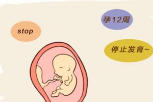 预防胚胎停育的十个注意事项