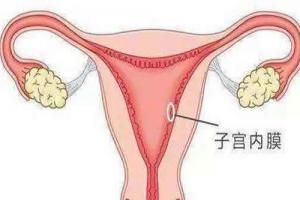 解决子宫内膜薄最好的5种治疗方法