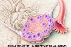 多囊卵巢怎么促排卵怀孕，多囊卵巢促排卵成功率高吗？