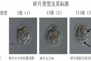 试管婴儿三级胚胎可以移植吗？专家解读来了…