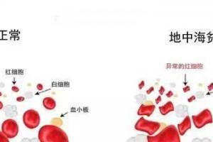 关于第三代试管婴儿可筛选遗传病-地中海贫血的报告解读