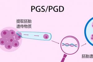 第三代试管婴儿适合人群介绍