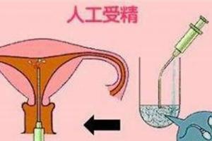 人工授精最好的医院-全国人工授精医院排行榜给到你