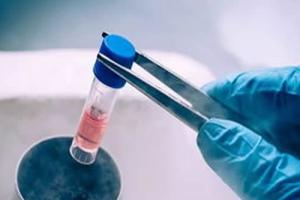 解冻移植前检查项目,这份明细表让你看得一清二楚