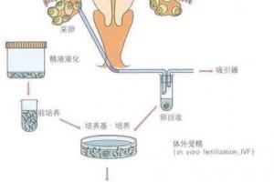 详细分析三代试管婴儿的各自优缺点，患者可根据自身需求选择
