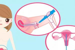 用最简洁的文字让你了解宫腔粘连的危害和诊断以及治疗方式