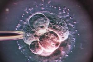 专家解读试管婴儿胚胎移植的最佳时间