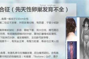 特纳氏综合征是可以做试管婴儿的,但是成功率只有20%左右!