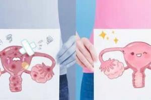 卵巢功能衰退闭经调理就用这7招