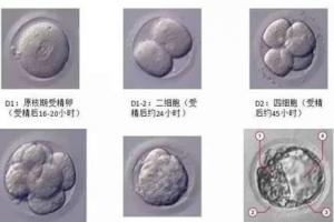 试管养囊失败的原因-专家解析主要原因是这四个