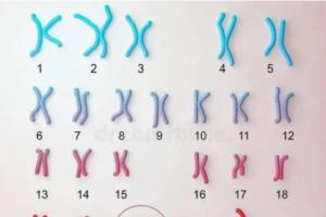 揭秘什么是小儿唐氏综合征的症状及形成的原因有哪些