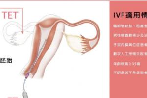 试管婴儿流程介绍