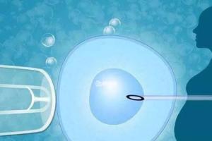 想生儿子可以做第三代试管婴儿选性别吗？费用是多少？
