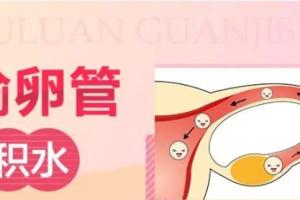 输卵管两侧都堵了还有积水能试管吗？