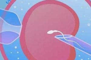 成都试管代怀生子助孕机构多少钱？成都试管婴儿双胞胎价格一览！
