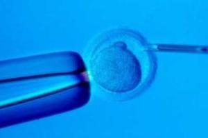 想生双胞胎只能通过做试管婴儿实现吗？