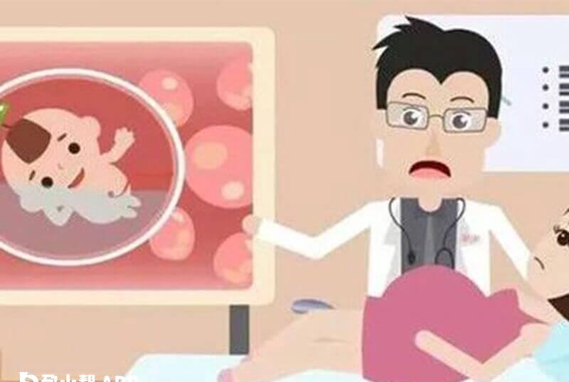 nt风险值怎么判断