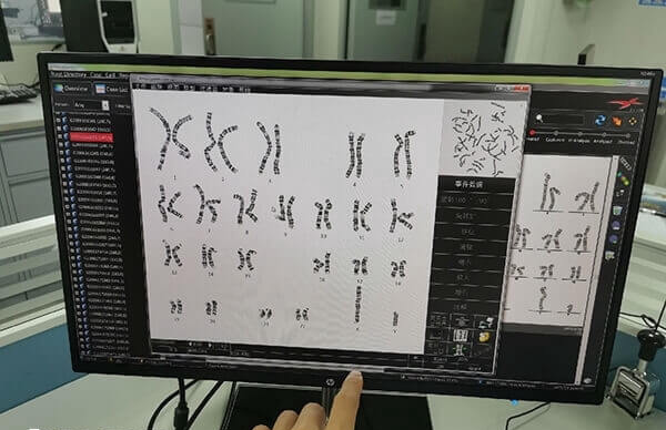 试管婴儿唐氏儿的概率是多少