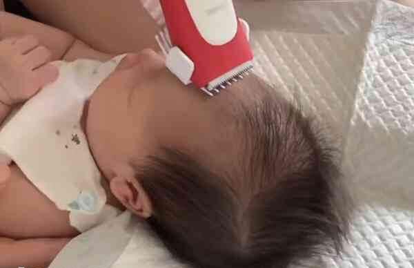 宝宝头发少、黄、秃怎么回事