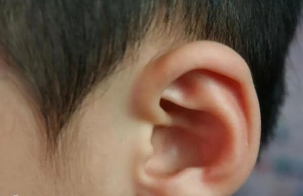 大富大贵的婴儿面相是怎么样的