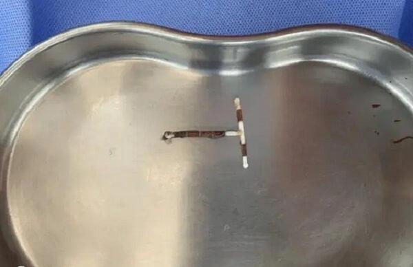 吉妮环的优缺点有哪些