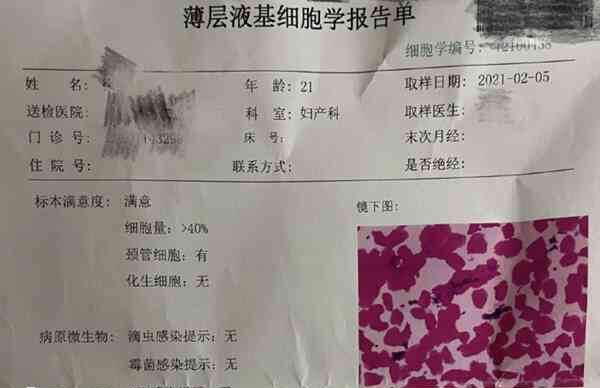 tct检查费用多少