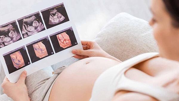 孕检单怎么看男女