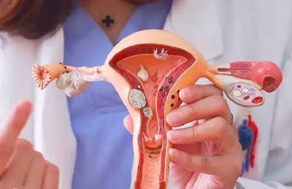 子宫内膜增生症的预防方法