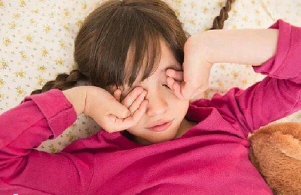 如何判断宝宝有没有倒睫