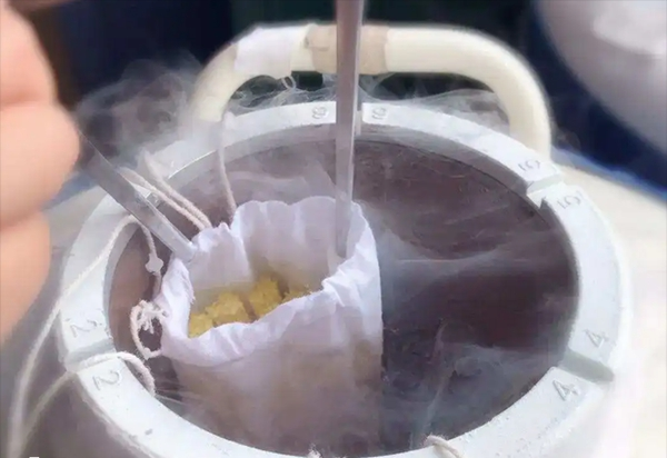 上海供精人工授精费用多少