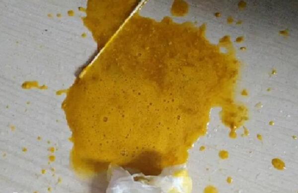 宝宝拉泡沫便的原因