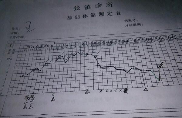 常见的测排卵方法