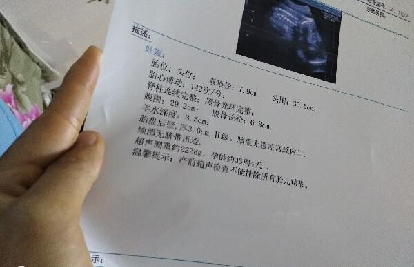 顺产看双顶径还是头围