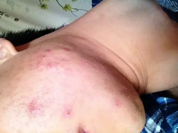 内分泌失调的症状有哪些