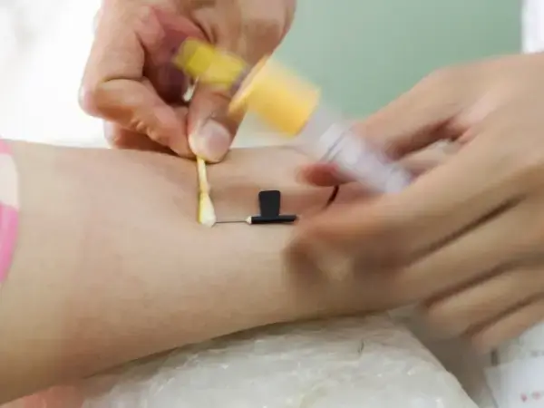 试管婴儿过程做b超和抽血的意义是什么